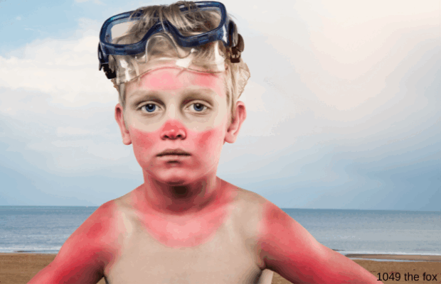 31% of people say this is the worst part of Summer.